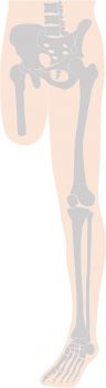 大腿切断の図