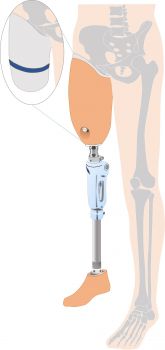 大腿義足シールインタイプの図