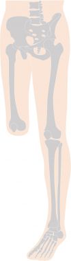 膝離断の図