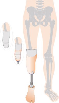 下腿義足シールインタイプの図