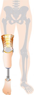 下腿義足差込式の図