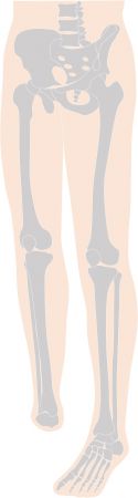 足関節切断の図