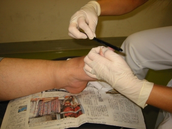 （写真１）切れない爪は看護師がやすりで磨きます