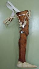 （写真１）差込式大腿義足（殻構造、アルミ製。40年前に製作。）