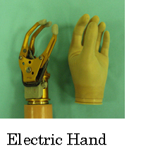 Electric Hand