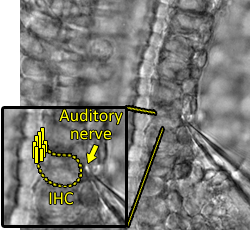 Postsynaptic recording from an auditory nerve