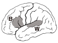 Broca's area