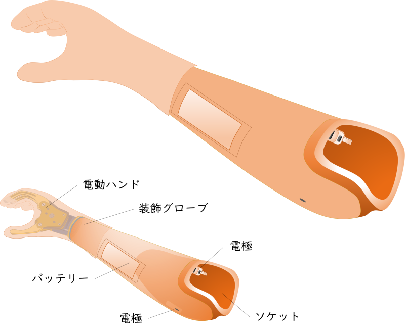 筋電電動義手の図