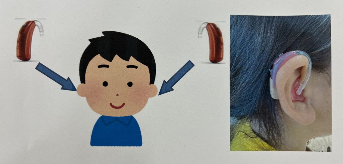 重複障害例で使用している予告カードの写真