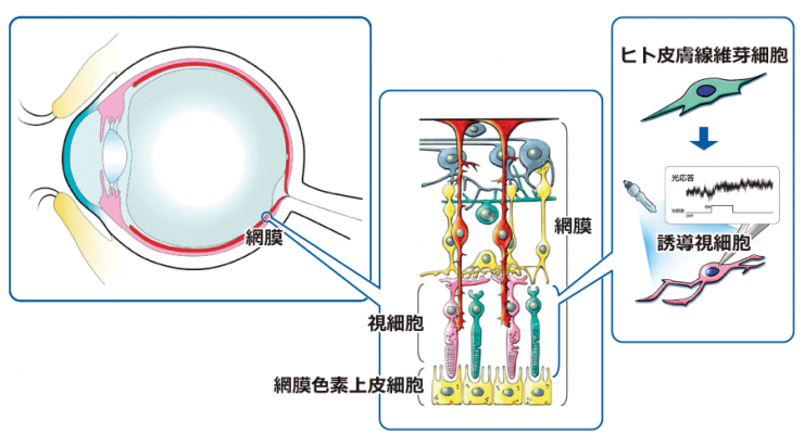 研究概要 網膜の画像