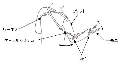 能動義手（上腕）の構造と肩関節を利用した手先具開閉の動作