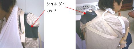 能動義手のショルダーカップとハーネス
