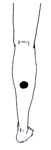 (}2)Ru傤v