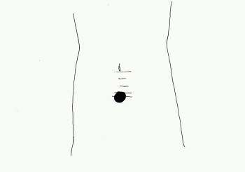 i}Rj֌u񂰂v