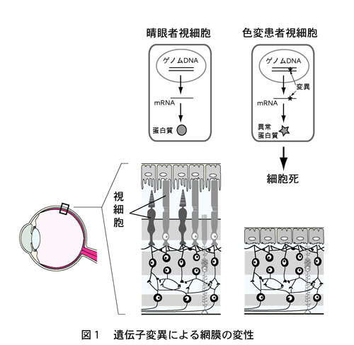 (図1)遺伝子変異による網膜の変性