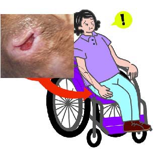 Does this wheelchair suit me?