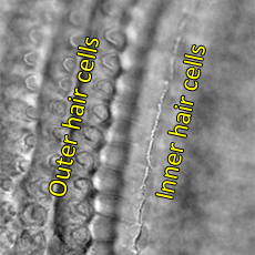 Mouse organ of Corti